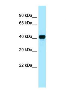 CKB / Creatine Kinase BB Antibody - CKB antibody Western blot of Fetal Heart lysate. Antibody concentration 1 ug/ml.  This image was taken for the unconjugated form of this product. Other forms have not been tested.