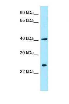 CKB / Creatine Kinase BB Antibody - CKB antibody Western blot of Fetal Heart lysate. Antibody concentration 1 ug/ml.  This image was taken for the unconjugated form of this product. Other forms have not been tested.