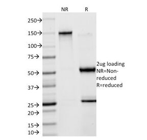 CKB / Creatine Kinase BB Antibody - SDS-PAGE Analysis of Purified, BSA-Free Creatine kinase B type Antibody (clone 2ba6). Confirmation of Integrity and Purity of the Antibody.
