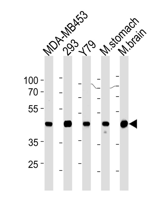CKB / Creatine Kinase BB Antibody - Creatine Kinase BB (CKB) Antibody western blot of MDA-MB453,293,Y79 cell line ,mouse stomach and brain tissue lysates (35 ug/lane). The CKB antibody detected the CKB protein (arrow).