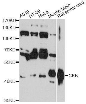 CKB / Creatine Kinase BB Antibody - Western blot analysis of extracts of various cell lines, using CKB antibody at 1:3000 dilution. The secondary antibody used was an HRP Goat Anti-Rabbit IgG (H+L) at 1:10000 dilution. Lysates were loaded 25ug per lane and 3% nonfat dry milk in TBST was used for blocking. An ECL Kit was used for detection and the exposure time was 60s.