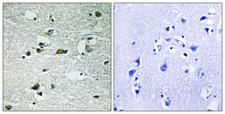 CKI-Gamma 1+2+3 Antibody - P-peptide - + Immunohistochemistry analysis of paraffin-embedded human brain tissue using CK-1?1/2/3 (Phospho-Tyr263) antibody. CK-1?1/2/3 (Phospho-Tyr263) antibody reacts with epitope-specific phosphopeptide and corresponding non-phosphopeptide.