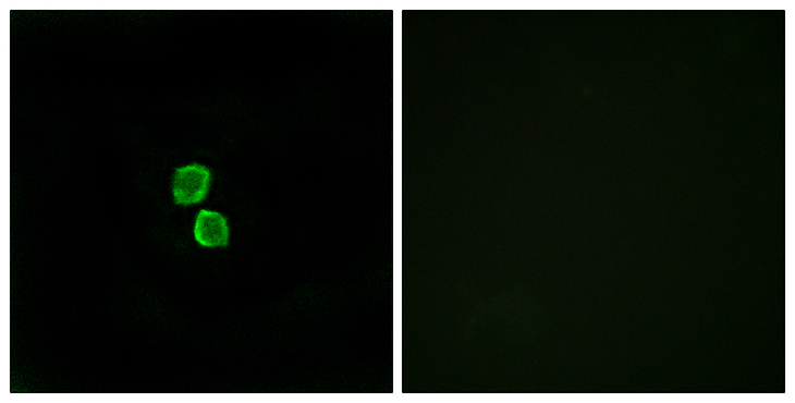 CKLF Antibody - Immunofluorescence analysis of MCF7 cells, using CKLF1 Antibody. The picture on the right is blocked with the synthesized peptide.