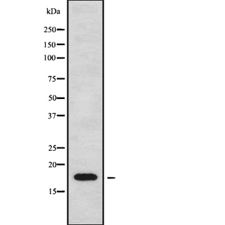 CKLF Antibody - Western blot analysis of CKLF using Jurkat whole cells lysates