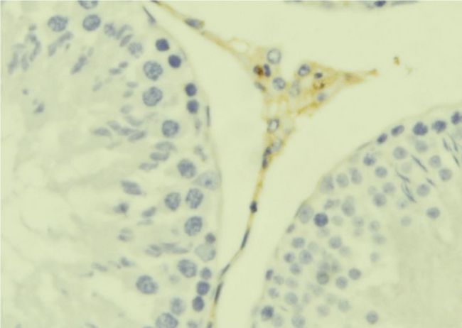 CKLF Antibody - 1:100 staining mouse testis tissue by IHC-P. The sample was formaldehyde fixed and a heat mediated antigen retrieval step in citrate buffer was performed. The sample was then blocked and incubated with the antibody for 1.5 hours at 22°C. An HRP conjugated goat anti-rabbit antibody was used as the secondary.