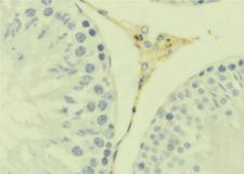 CKLF Antibody - 1:100 staining mouse testis tissue by IHC-P. The sample was formaldehyde fixed and a heat mediated antigen retrieval step in citrate buffer was performed. The sample was then blocked and incubated with the antibody for 1.5 hours at 22°C. An HRP conjugated goat anti-rabbit antibody was used as the secondary.