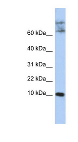 CKLF Antibody - CKLF antibody Western blot of Jurkat lysate. This image was taken for the unconjugated form of this product. Other forms have not been tested.