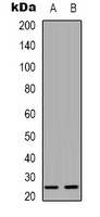 CKLFSF4 / CMTM4 Antibody - Western blot analysis of CMTM4 expression in HeLa (A); A431 (B) whole cell lysates.