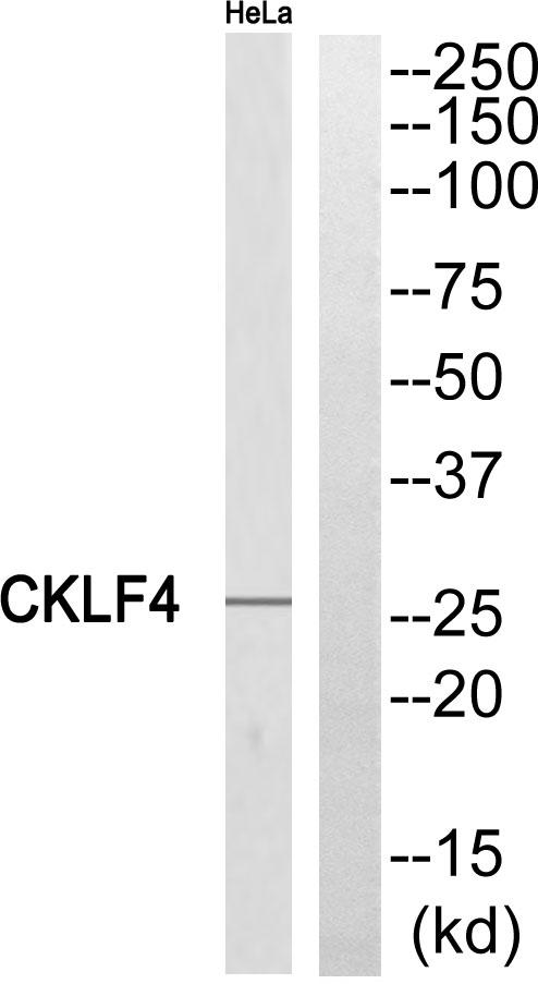 CKLFSF4 / CMTM4 Antibody - Western blot analysis of extracts from HeLa cells, using CKLF4 antibody.