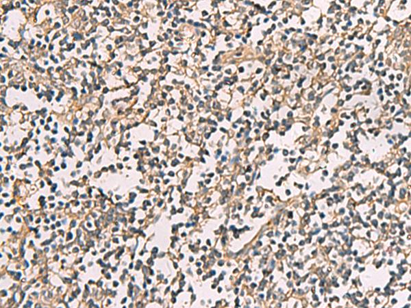CKLFSF4 / CMTM4 Antibody - Immunohistochemistry of paraffin-embedded Human tonsil tissue  using CMTM4 Polyclonal Antibody at dilution of 1:55(×200)