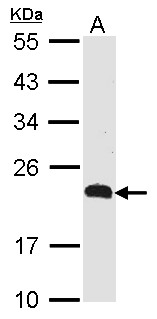 CKLFSF5 / CMTM5 Antibody - Sample (30 ug of whole cell lysate). A: Raji. 12% SDS PAGE. CKLFSF5 antibody. CKLFSF5 / CMTM5 antibody diluted at 1:500.
