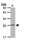 CKLFSF5 / CMTM5 Antibody - Sample (30 ug of whole cell lysate). A: MOLT4 whole cell lysate . 12% SDS PAGE. CKLFSF5 / CMTM5 antibody diluted at 1:1000