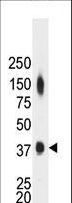 CKM / Creatine Kinase MM Antibody - The anti-CKM antibody is used in Western blot to detect CKM in mouse heart tissue lysate.