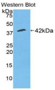 CKM / Creatine Kinase MM Antibody - Western blot of recombinant CKM / Creatine Kinase MM.  This image was taken for the unconjugated form of this product. Other forms have not been tested.