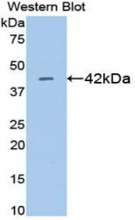 CKM / Creatine Kinase MM Antibody - Western blot of recombinant CKM / Creatine Kinase MM.  This image was taken for the unconjugated form of this product. Other forms have not been tested.