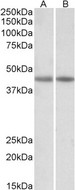 CKM / Creatine Kinase MM Antibody - CKM antibody (0.03 ug/ml) staining of Human (A) and Mouse (B) Heart lysates (35 ug protein in RIPA buffer). Primary incubation was 1 hour. Detected by chemiluminescence.