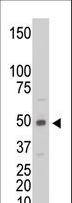 CKM / Creatine Kinase MM Antibody - The anti-CKM antibody is used in Western blot to detect CKM in C6 cell lysate.