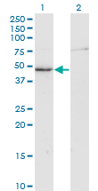 CKM / Creatine Kinase MM Antibody - Western Blot analysis of CKM expression in transfected 293T cell line by CKM monoclonal antibody (M01), clone 3E1-F3.Lane 1: CKM transfected lysate (Predicted MW: 43.1 KDa).Lane 2: Non-transfected lysate.