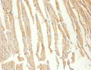 CKM / Creatine Kinase MM Antibody - Immunohistochemistry of paraffin-embedded Mouse heart tissue using CKM Antibody at dilution of 1:100