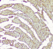 CKM / Creatine Kinase MM Antibody - IHC analysis of Creatine Kinase MM using anti-Creatine Kinase MM antibody. Creatine Kinase MM was detected in paraffin-embedded section of rat cardiac muscle tissue. Heat mediated antigen retrieval was performed in citrate buffer (pH6, epitope retrieval solution) for 20 mins. The tissue section was blocked with 10% goat serum. The tissue section was then incubated with 1µg/ml rabbit anti-Creatine Kinase MM Antibody overnight at 4°C. Biotinylated goat anti-rabbit IgG was used as secondary antibody and incubated for 30 minutes at 37°C. The tissue section was developed using Strepavidin-Biotin-Complex (SABC) with DAB as the chromogen.
