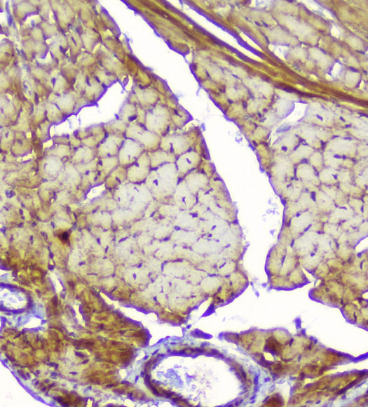 CKM / Creatine Kinase MM Antibody - IHC analysis of Creatine Kinase MM using anti-Creatine Kinase MM antibody. Creatine Kinase MM was detected in paraffin-embedded section of mouse cardiac muscle tissue. Heat mediated antigen retrieval was performed in citrate buffer (pH6, epitope retrieval solution) for 20 mins. The tissue section was blocked with 10% goat serum. The tissue section was then incubated with 1µg/ml rabbit anti-Creatine Kinase MM Antibody overnight at 4°C. Biotinylated goat anti-rabbit IgG was used as secondary antibody and incubated for 30 minutes at 37°C. The tissue section was developed using Strepavidin-Biotin-Complex (SABC) with DAB as the chromogen.