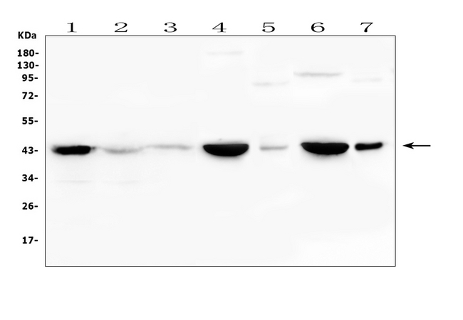 CKM / Creatine Kinase MM Antibody - Western blot analysis of Creatine Kinase MM using anti-Creatine Kinase MM antibody. Electrophoresis was performed on a 5-20% SDS-PAGE gel at 70V (Stacking gel) / 90V (Resolving gel) for 2-3 hours. The sample well of each lane was loaded with 50ug of sample under reducing conditions. Lane 1: human K562 whole cell lysate,Lane 2: human CNE whole cell lysate,Lane 3: human COLO-320 whole cell lysate,Lane 4: rat heart tissue lysates,Lane 5: rat lung tissue lysates,Lane 6: mouse heart tissue lysates,Lane 7: mouse lung tissue lysates. After Electrophoresis, proteins were transferred to a Nitrocellulose membrane at 150mA for 50-90 minutes. Blocked the membrane with 5% Non-fat Milk/ TBS for 1.5 hour at RT. The membrane was incubated with rabbit anti-Creatine Kinase MM antigen affinity purified polyclonal antibody at 0.5 µg/mL overnight at 4°C, then washed with TBS-0.1% Tween 3 times with 5 minutes each and probed with a goat anti-rabbit IgG-HRP secondary antibody at a dilution of 1:10000 for 1.5 hour at RT. The signal is developed using an Enhanced Chemiluminescent detection (ECL) kit with Tanon 5200 system. A specific band was detected for Creatine Kinase MM at approximately 43KD. The expected band size for Creatine Kinase MM is at 43KD.