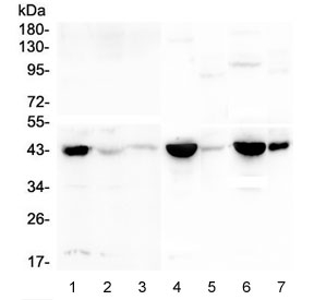 CKM / Creatine Kinase MM Antibody - Western blot testing of 1) human K562, 2) human CNE, 3) human COLO-320, 4) rat heart, 5) rat lung, 6) mouse heart and 7) mouse lung lysate with CKM antibody at 0.5ug/ml. Predicted molecular weight ~43 kDa.