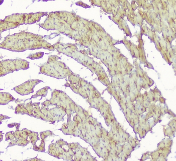 CKM / Creatine Kinase MM Antibody - IHC staining of FFPE rat heart with CKM antibody at 1ug/ml. HIER: boil tissue sections in pH6, 10mM citrate buffer, for 10-20 min followed by cooling at RT for 20 min.