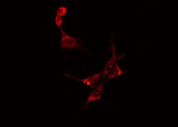 CKM / Creatine Kinase MM Antibody - Staining HeLa cells by IF/ICC. The samples were fixed with PFA and permeabilized in 0.1% Triton X-100, then blocked in 10% serum for 45 min at 25°C. The primary antibody was diluted at 1:200 and incubated with the sample for 1 hour at 37°C. An Alexa Fluor 594 conjugated goat anti-rabbit IgG (H+L) antibody, diluted at 1/600, was used as secondary antibody.