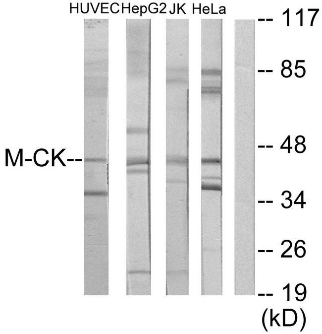 CKM / Creatine Kinase MM Antibody - Western blot analysis of extracts from HUVEC cells, HepG2 cells, Jurkat cells and HeLa cells, using M-CK antibody.