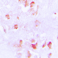CKM / Creatine Kinase MM Antibody - Immunohistochemical analysis of Creatine Kinase M staining in human brain formalin fixed paraffin embedded tissue section. The section was pre-treated using heat mediated antigen retrieval with sodium citrate buffer (pH 6.0). The section was then incubated with the antibody at room temperature and detected using an HRP conjugated compact polymer system. DAB was used as the chromogen. The section was then counterstained with hematoxylin and mounted with DPX.