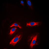 CKM / Creatine Kinase MM Antibody - Immunofluorescent analysis of Creatine Kinase M staining in NIH3T3 cells. Formalin-fixed cells were permeabilized with 0.1% Triton X-100 in TBS for 5-10 minutes and blocked with 3% BSA-PBS for 30 minutes at room temperature. Cells were probed with the primary antibody in 3% BSA-PBS and incubated overnight at 4 C in a humidified chamber. Cells were washed with PBST and incubated with a DyLight 594-conjugated secondary antibody (red) in PBS at room temperature in the dark. DAPI was used to stain the cell nuclei (blue).