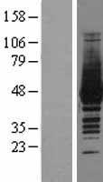 CKM / Creatine Kinase MM Protein - Western validation with an anti-DDK antibody * L: Control HEK293 lysate R: Over-expression lysate