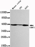 CKMT1 Antibody - Western blot detection of CKMT1 in Mouse Colon,293&A431 cell lysates using CKMT1 antibody (1:1000 diluted).