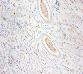 CKMT1 Antibody - Immunohistochemistry of paraffin-embedded human kidney tissue using CKMT1A Antibody at dilution of 1:100