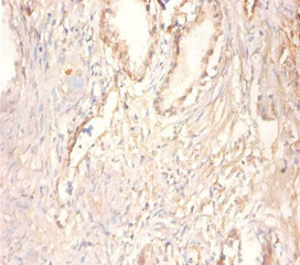 CKMT1 Antibody - Immunohistochemistry of paraffin-embedded human prostate tissue using CKMT1A Antibody at dilution of 1:100