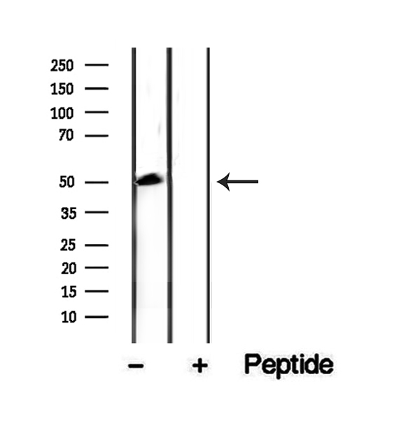 CKMT1 Antibody - Western blot analysis of extracts of rat heart tissue using CKMT1A antibody.