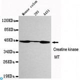 CKMT1 Antibody - Western blot detection of CKMT1 in Mouse Colon, 293 and A431 cell lysates using CKMT1 mouse mAb (1:1000 diluted). Predicted band size: 47KDa. Observed band size: 47KDa.
