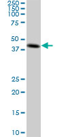 CKMT1B Antibody - CKMT1B monoclonal antibody (M04), clone 2C8. Western Blot analysis of CKMT1B expression in A-431.