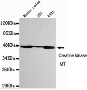 CKMT1B Antibody - Western blot detection of CKMT1 in Mouse Colon, 293 and A431 cell lysates using CKMT1 mouse monoclonal antibody (1:1000 dilution). Predicted band size: 47KDa. Observed band size:47KDa.