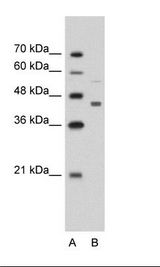 CKMT2 Antibody - A: Marker, B: Jurkat Cell Lysate.  This image was taken for the unconjugated form of this product. Other forms have not been tested.