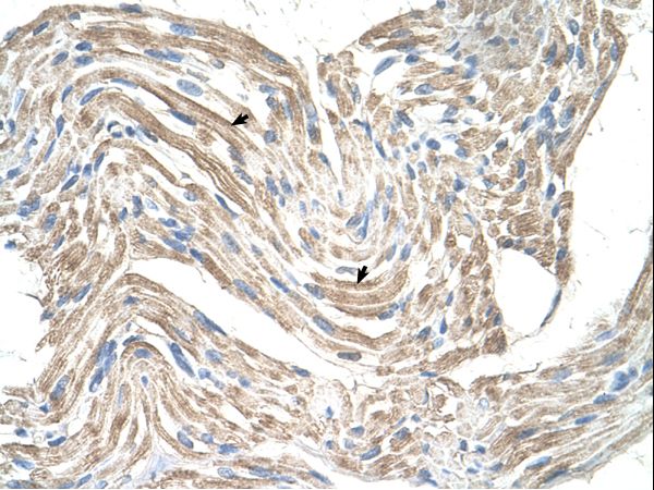 CKMT2 Antibody - CKMT2 antibody ARP41478_T100-NP_001816-CKMT2(creatine kinase, mitochondrial 2 (sarcomeric)) Antibody was used in IHC to stain formalin-fixed, paraffin-embedded human muscle.  This image was taken for the unconjugated form of this product. Other forms have not been tested.