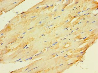 CKMT2 Antibody - Immunohistochemistry of paraffin-embedded human skeletal muscle using antibody at 1:100 dilution.