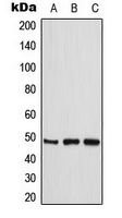 CKMT2 Antibody - Western blot analysis of CKMT2 expression in THP1 (A); HeLa (B); Jurkat (C) whole cell lysates.