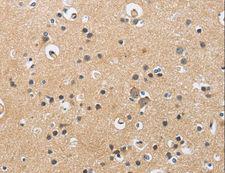 CKMT2 Antibody - Immunohistochemistry of paraffin-embedded Human brain using CKMT2 Polyclonal Antibody at dilution of 1:60.
