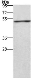 CKMT2 Antibody - Western blot analysis of Jurkat cell, using CKMT2 Polyclonal Antibody at dilution of 1:700.