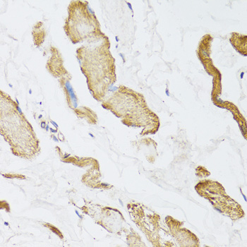 CKMT2 Antibody - Immunohistochemistry of paraffin-embedded human esophagus tissue.