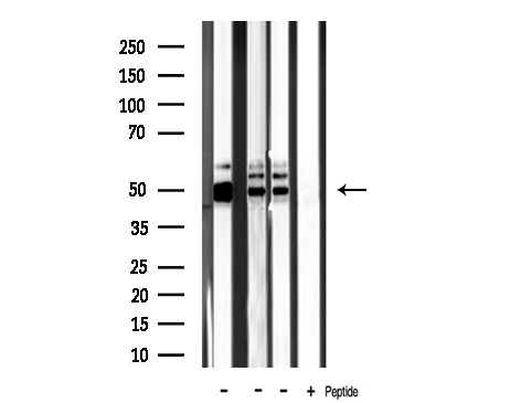 CKMT2 Antibody - Western blot analysis of CKMT2 antibody expression in mouse brain, mouse liver tissue and mouse kidney tissues lysates.