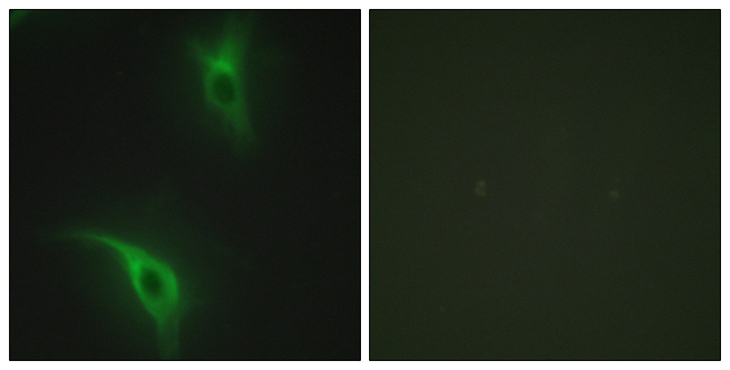 CKS1B / CKS1 Antibody - Immunofluorescence analysis of HeLa cells, using CKS1 Antibody. The picture on the right is blocked with the synthesized peptide.