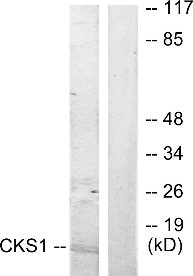 CKS1B / CKS1 Antibody - Western blot analysis of lysates from Jurkat cells, treated with serum 20% 15', using CKS1 Antibody. The lane on the right is blocked with the synthesized peptide.